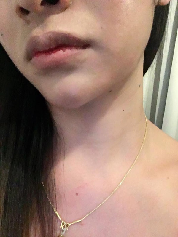 ขายบริการ 