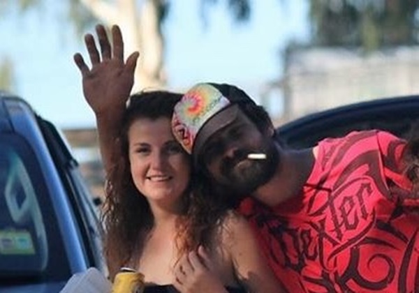  หนังหัวหลุดจากกะโหลก