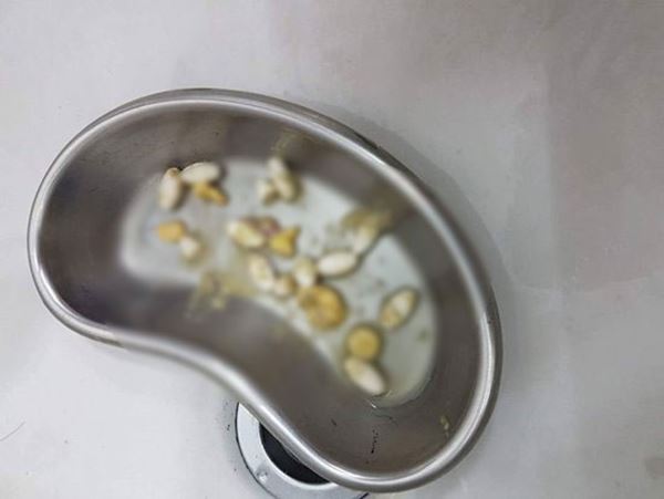 หมอฆ่าหมาเอาประกัน