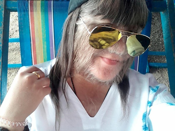  น้องแนท เด็กขนยาว