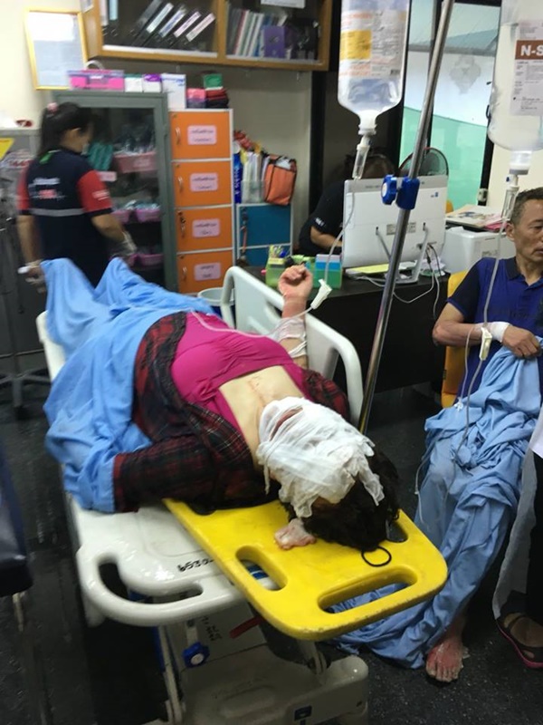 เรือสปีดโบ๊ท ระเบิดกลางเกาะพีพี 