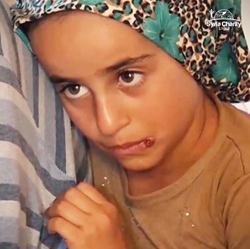 เด็กพิการ