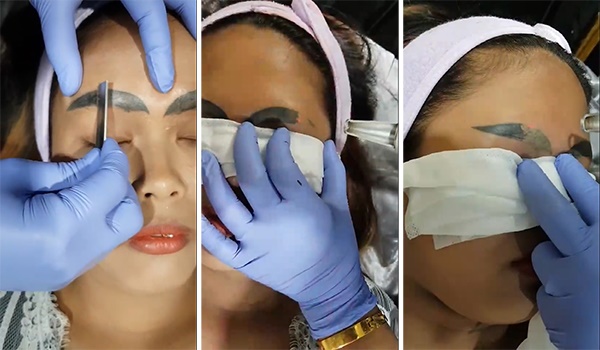  สักคิ้วพลาด