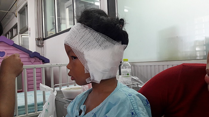 หมากัดเด็ก