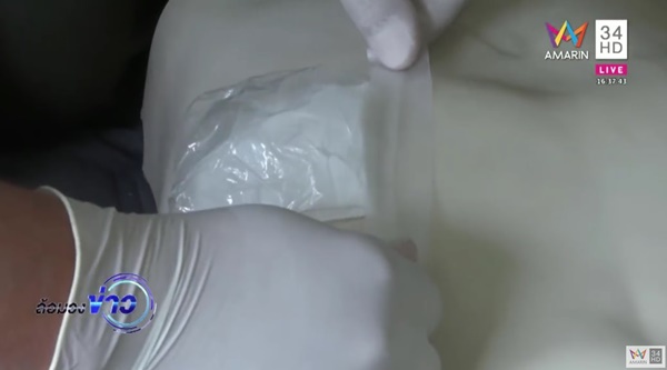 น้องเอิร์น ถูกแฟนเก่ายิง