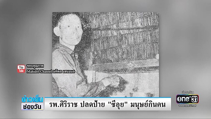 ศิริราชปลดป้าย มนุษย์กินคน พ้นร่าง ซีอุย