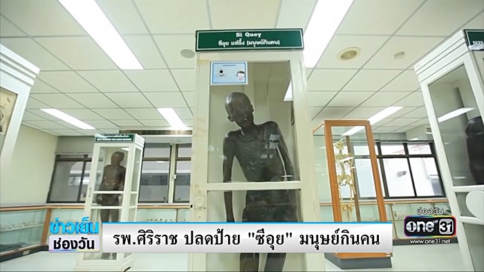 ศิริราชปลดป้าย มนุษย์กินคน พ้นร่าง ซีอุย