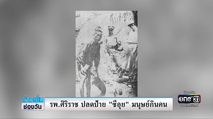 ศิริราชปลดป้าย มนุษย์กินคน พ้นร่าง ซีอุย