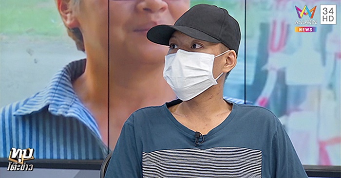 ป่วยเอดส์ 