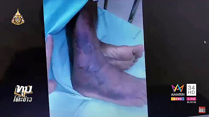 โวยโรงพยาบาล