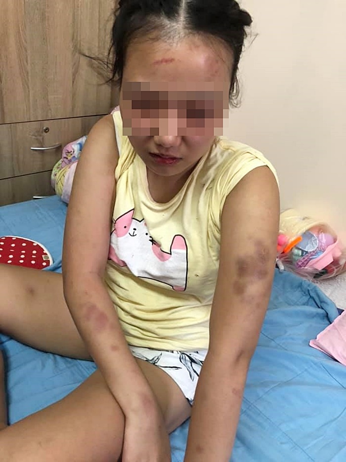 ทำร้ายแฟน