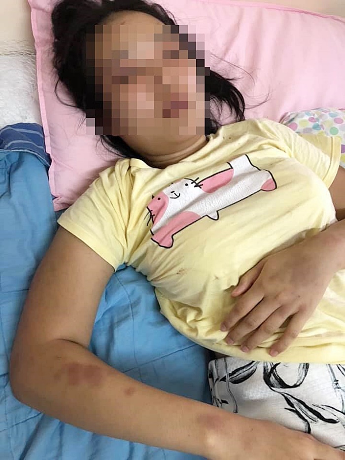 ทำร้ายแฟน