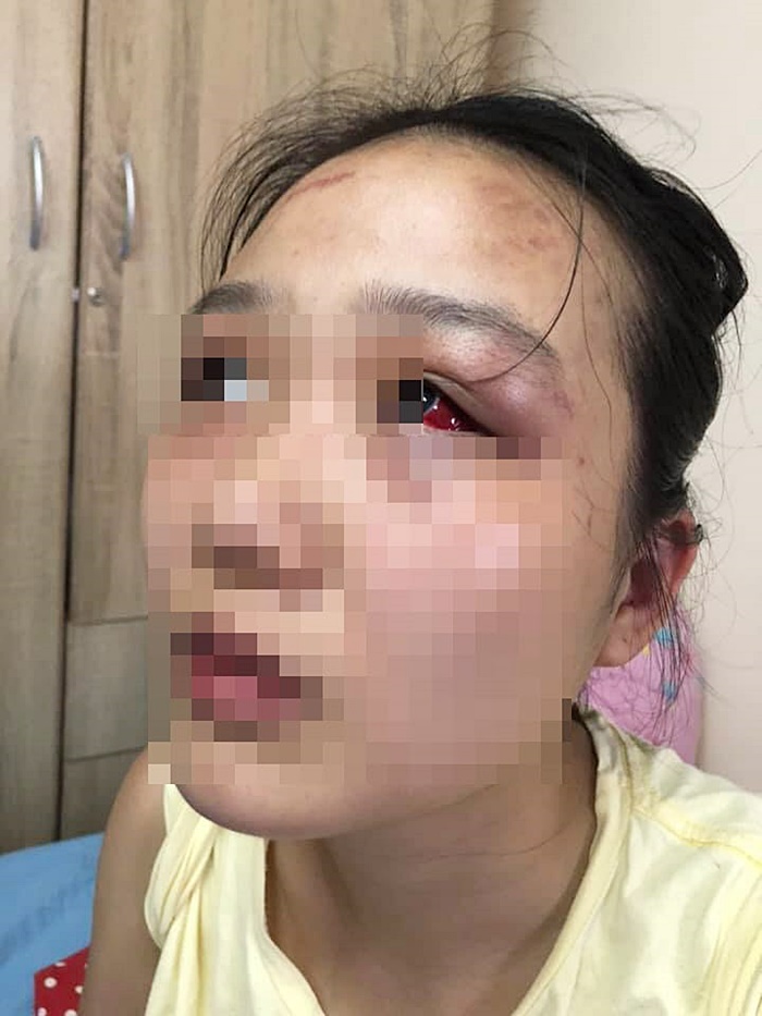 ทำร้ายแฟน