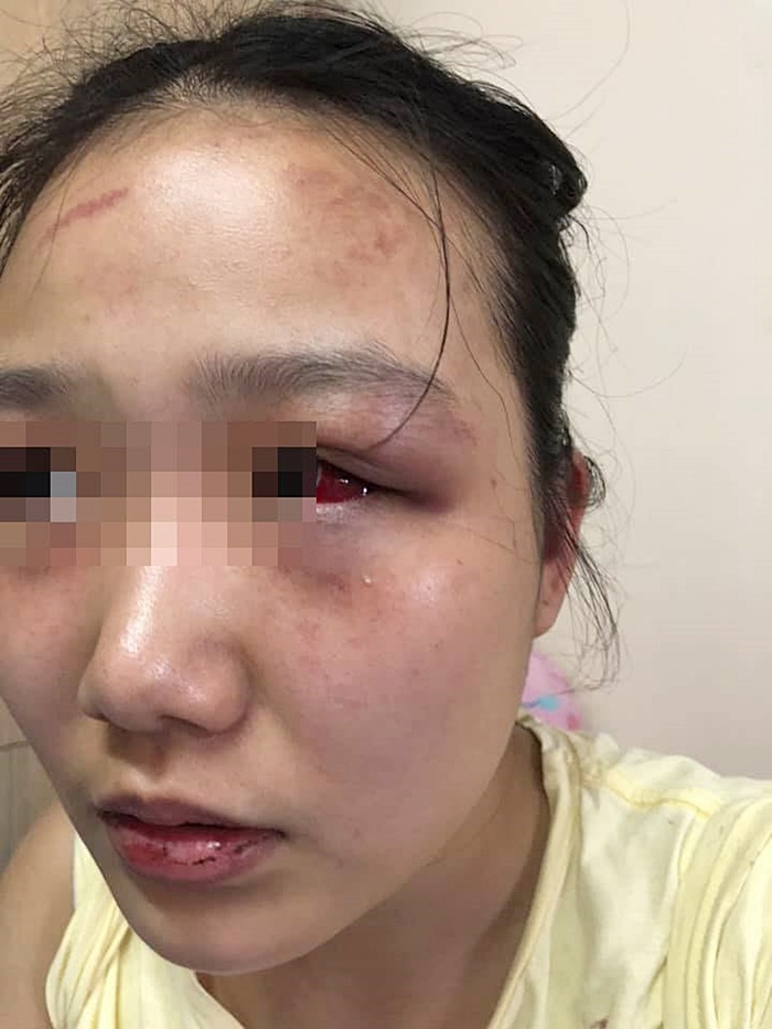 ทำร้ายแฟน