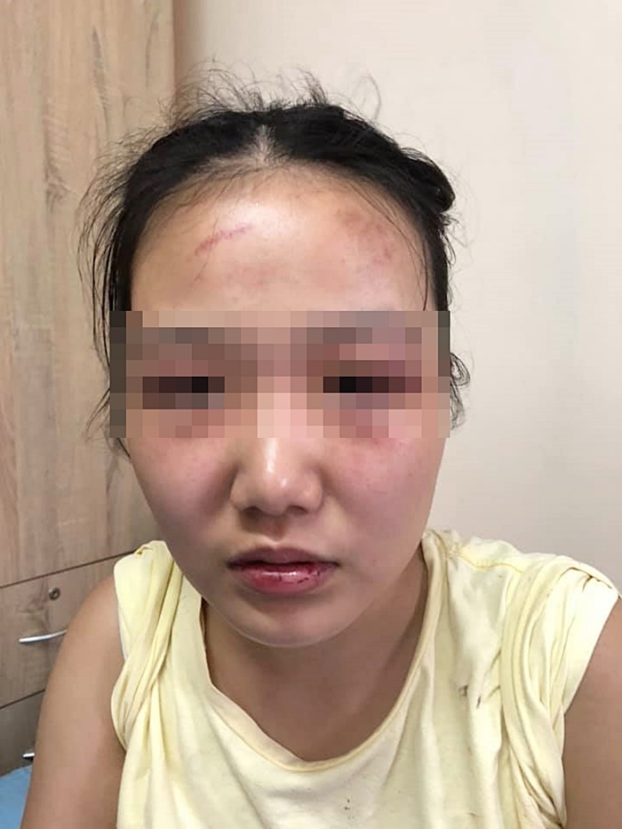 ทำร้ายแฟน