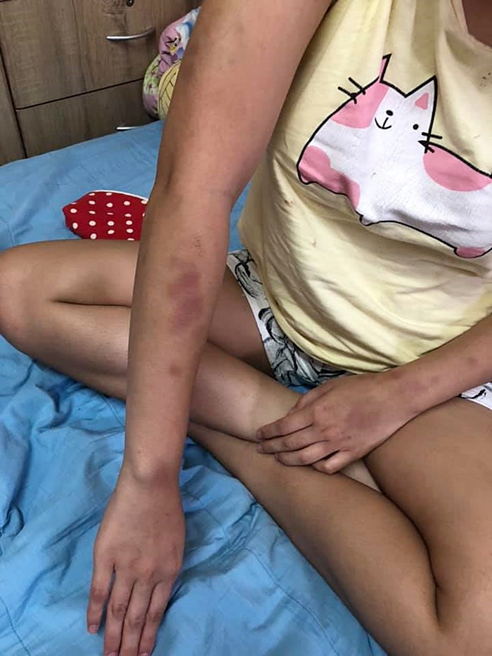 ทำร้ายแฟน