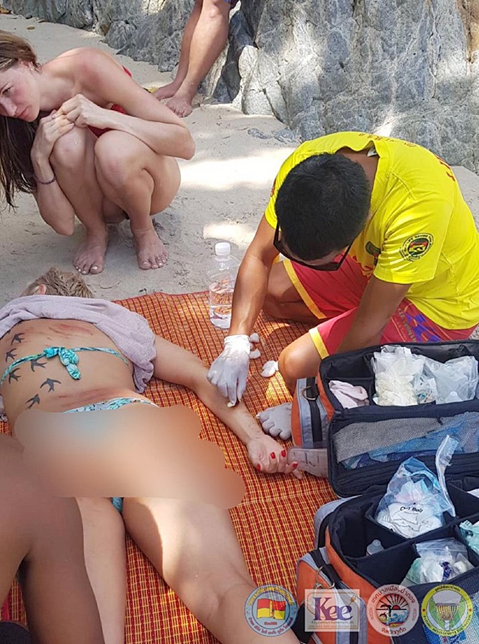  พลัดตกโขดหินที่ป่าตอง