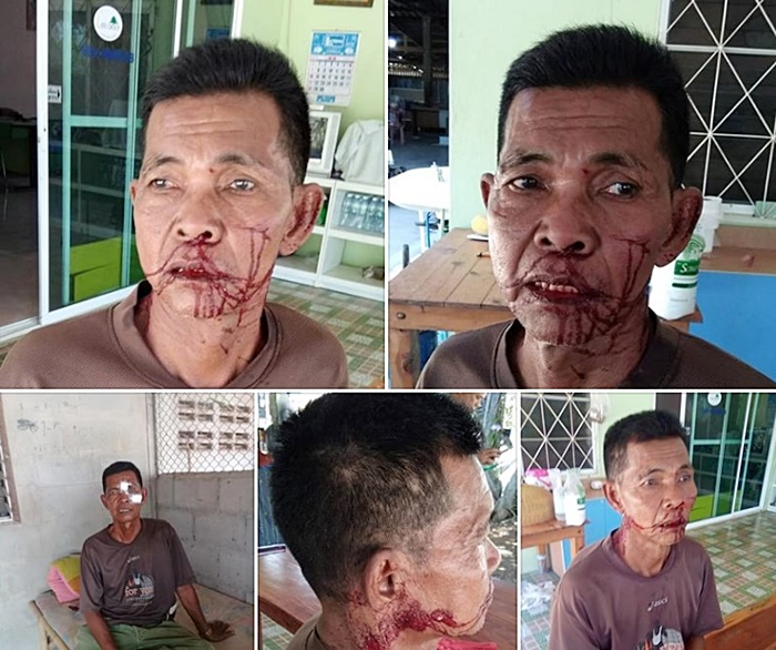ทำร้ายร่างกาย