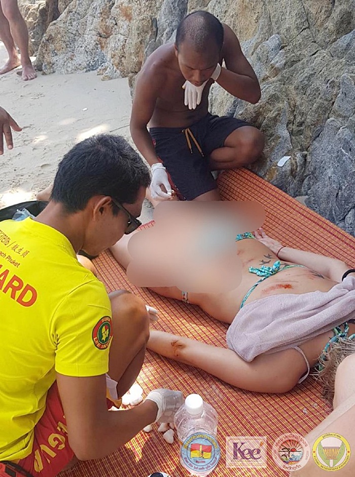  พลัดตกโขดหินที่ป่าตอง