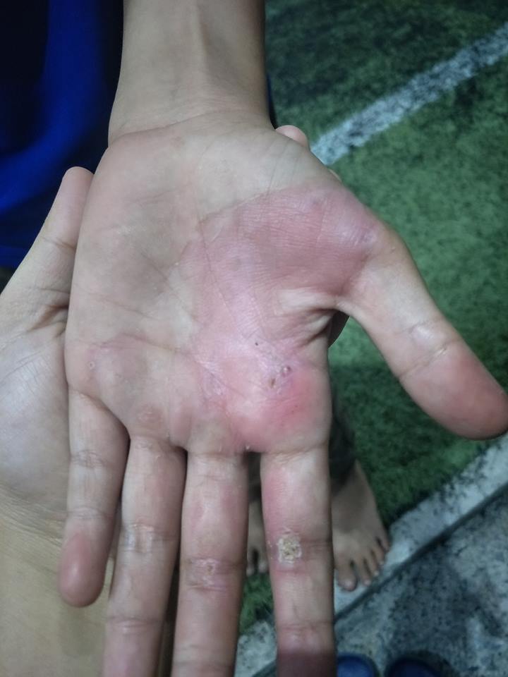 พ่อเลี้ยงทำร้ายลูก