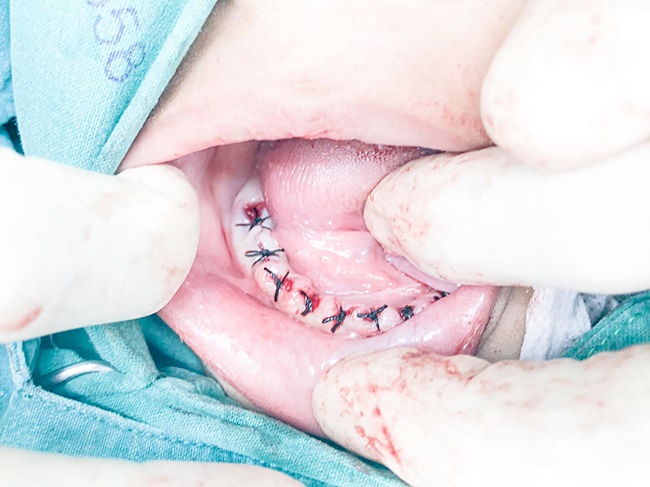 อุทาหรณ์พ่อแม่