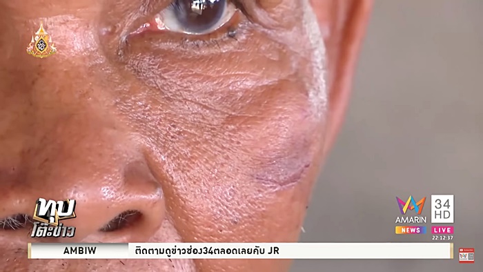 ทำร้ายร่างกาย