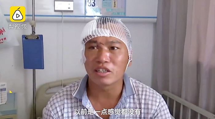 กิ่งไม้ฝังในกะโหลก