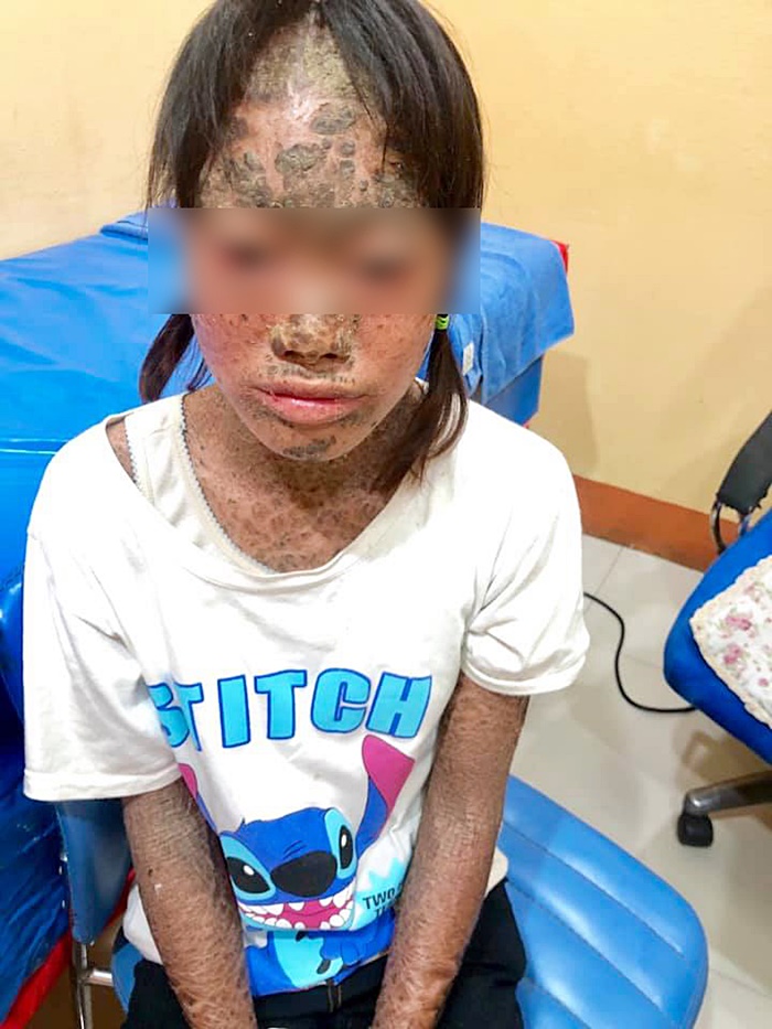 เด็กดักแด้ 