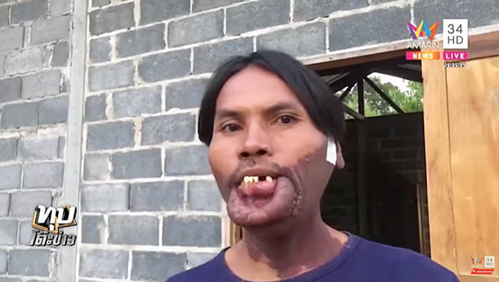  มีมี่ หนุ่มหน้าปาน