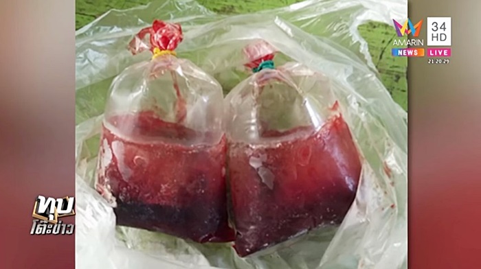 ปาถุงเลือด