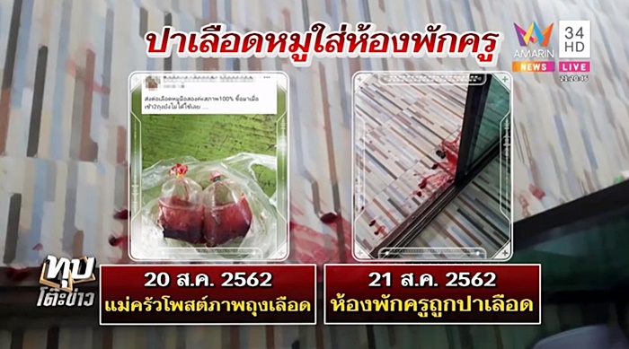 ปาถุงเลือด