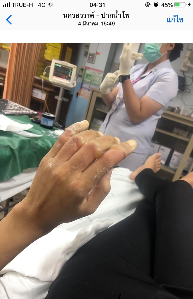 อบัติเหตุ