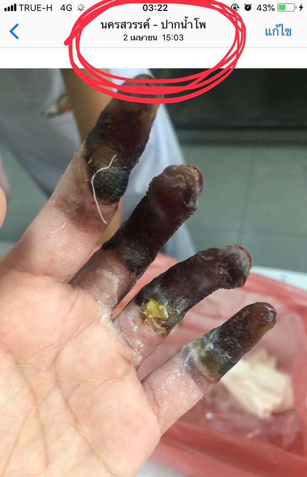 อบัติเหตุ