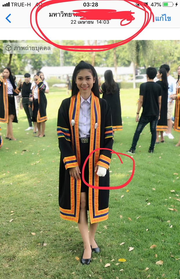 อบัติเหตุ
