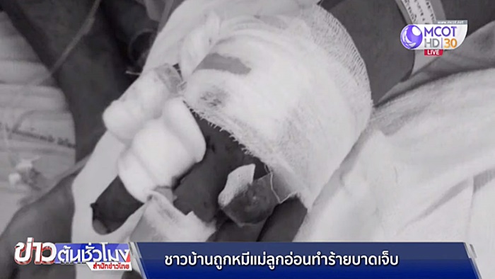 ระวังหมี 