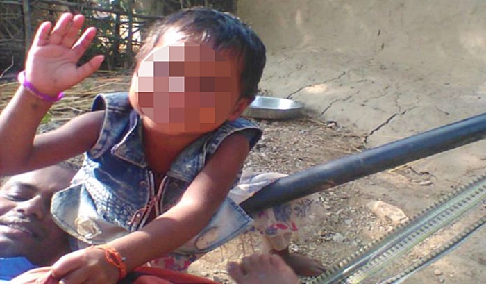 อุบัติเหตุเด็ก