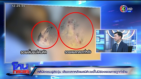 คดีน้องชมพู่