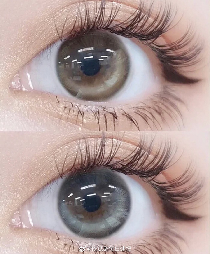 คอนแทคเลนส์