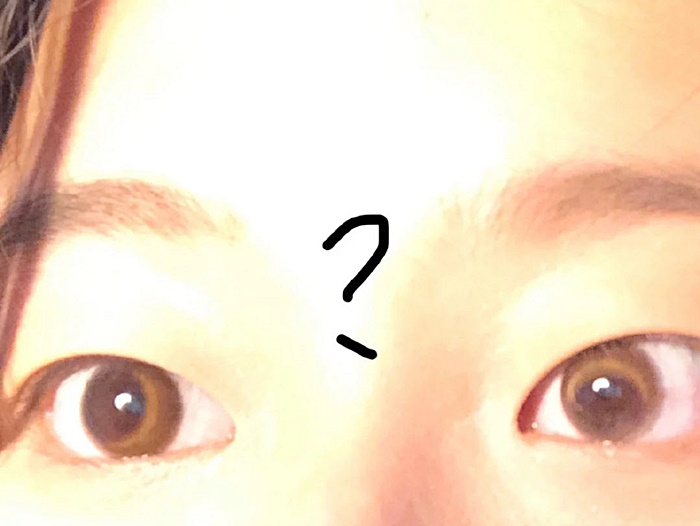 คอนแทคเลนส์