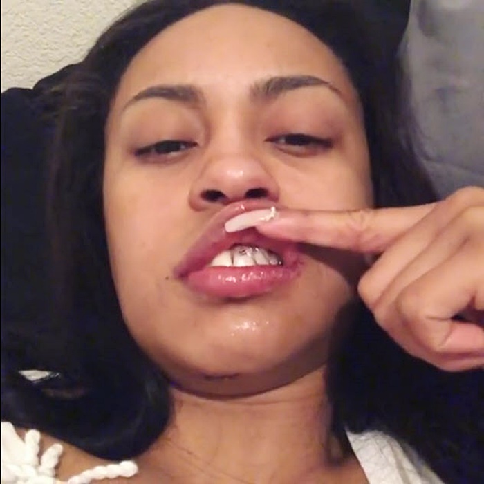 นักเต้นสาว ตกเสา 6 เมตร 