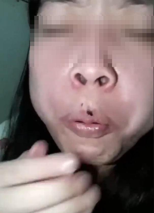 อันตราย