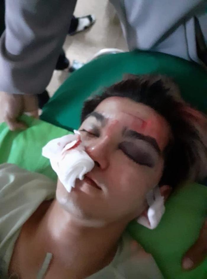 น้องแบงค์ นักเต้นรองแชมป์โลก ถูกรุมทำร้ายจนกะโหลกร้าว 