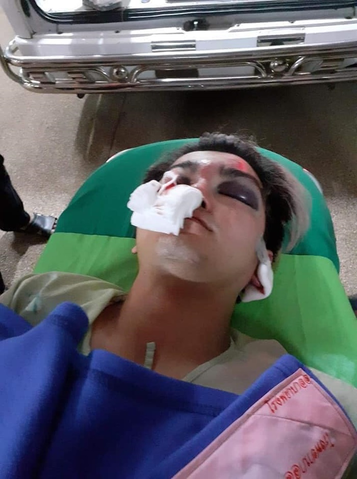 น้องแบงค์ นักเต้นรองแชมป์โลก ถูกรุมทำร้ายจนกะโหลกร้าว 