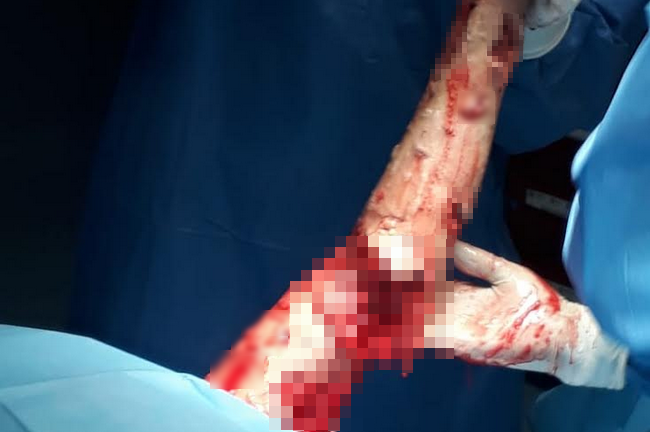 เสือดาวตะปบหน้า