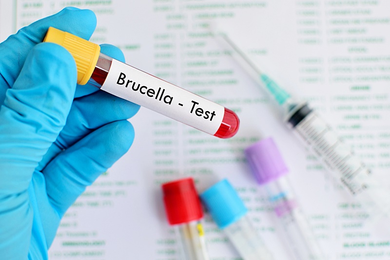ติดเชื้อบรูเซลลา