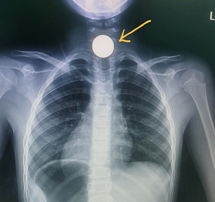 อุทาหรณ์พ่อแม่ 