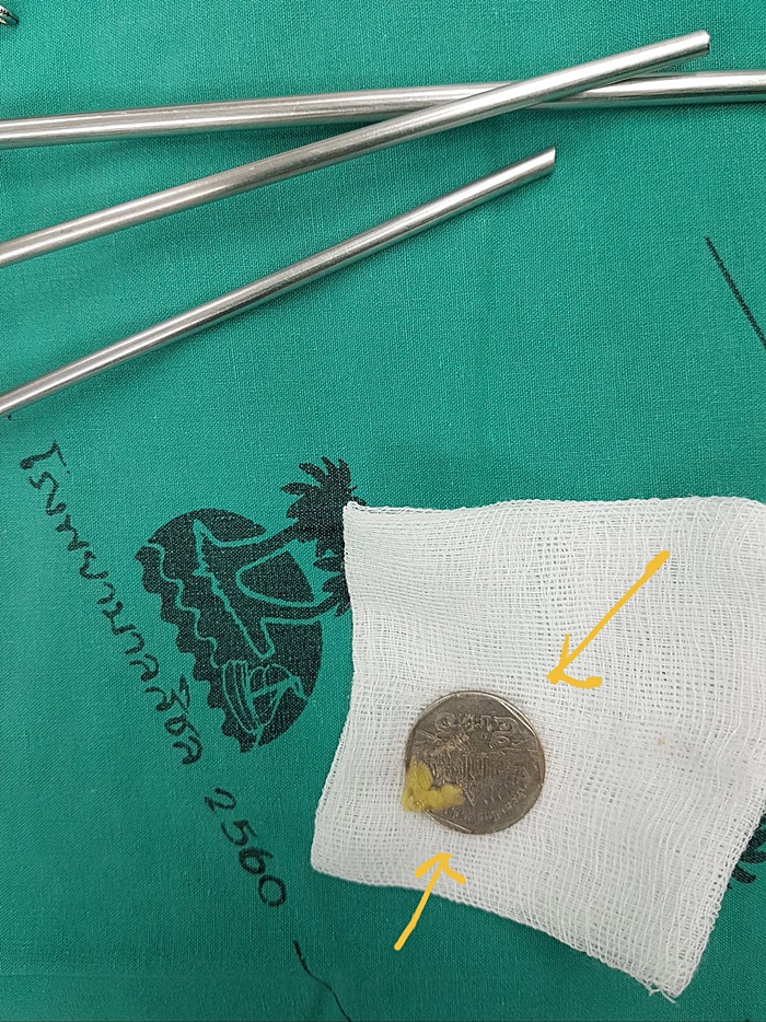 อุทาหรณ์พ่อแม่ 