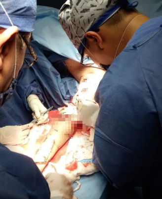 เสือดาวตะปบหน้า