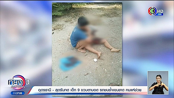 น้องแมนยู เด็กตาบอด