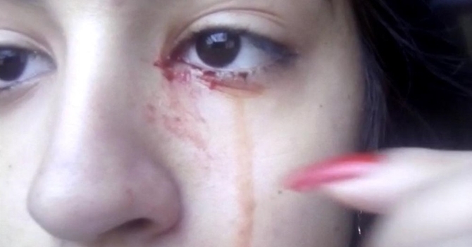 เด็กสาววัย 15 ร้องไห้น้ำตาไหลเป็นเลือด 